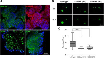 Airway basal cells from human-induced pluripotent stem cells: a new frontier in cystic fibrosis research